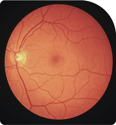retina